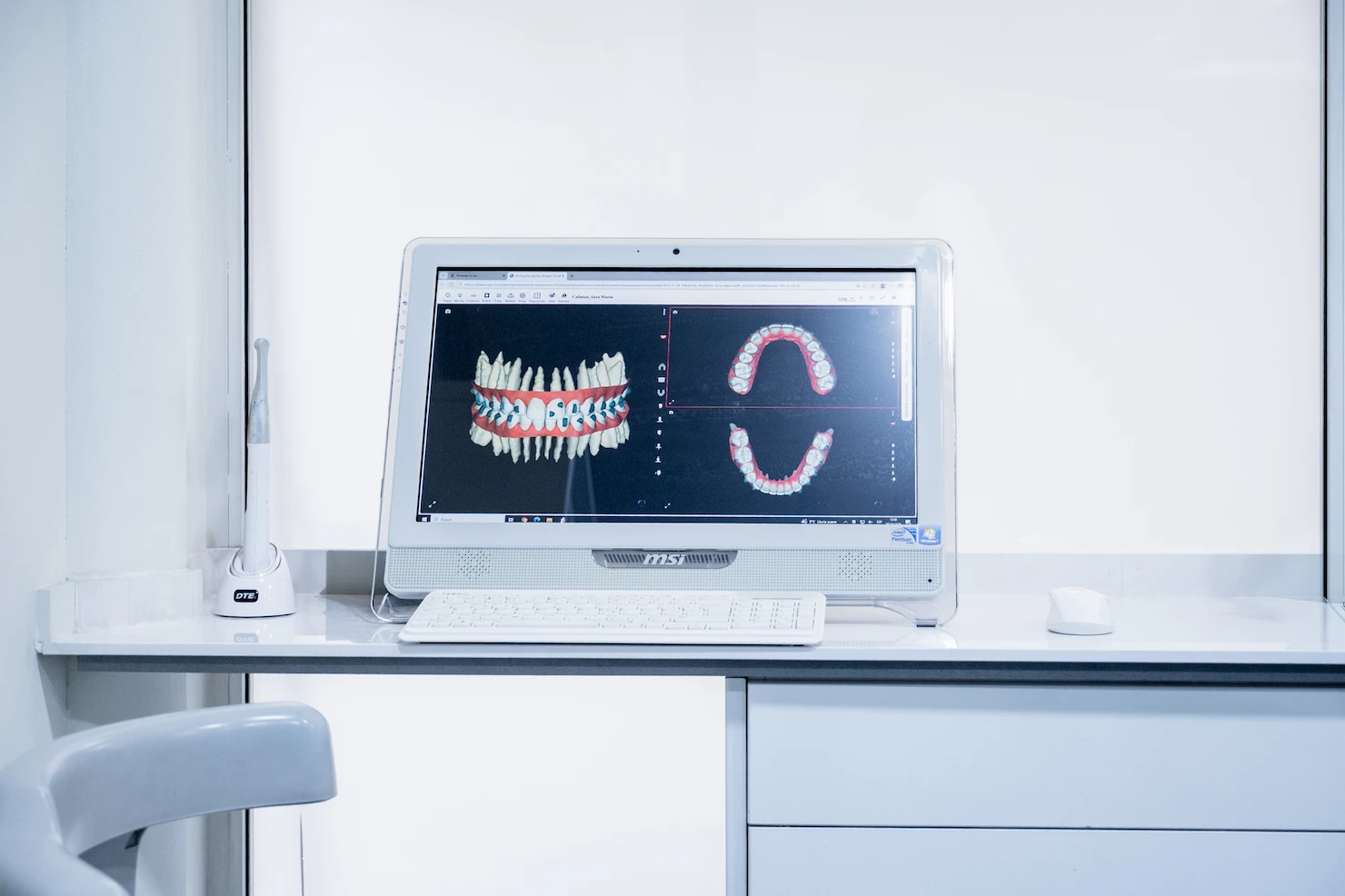 Ordenador mostrando imagen de diagnostico 4d dental | Odontología | Ortodoncia Invisible | Dentista cerca de mi